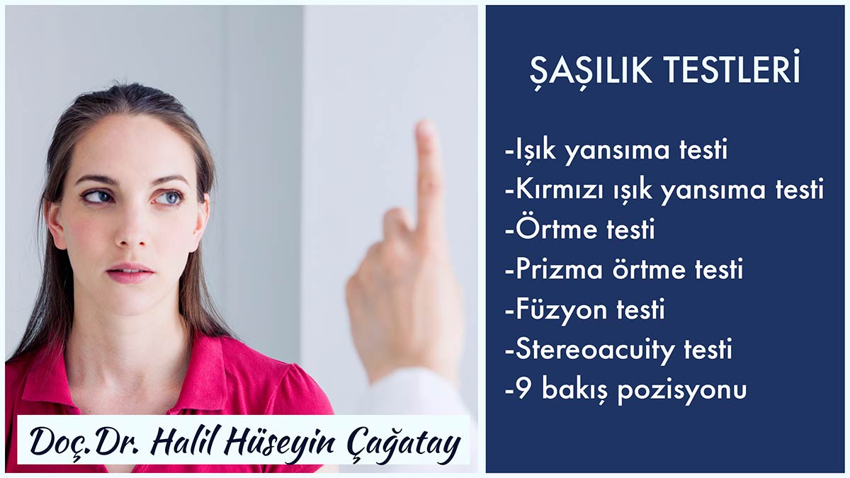 şaşılık testleri